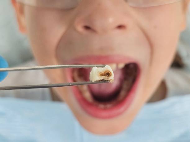 Best Pediatric Emergency Dentist in Gloucester Point, VA